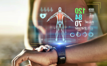 Wearable Technology