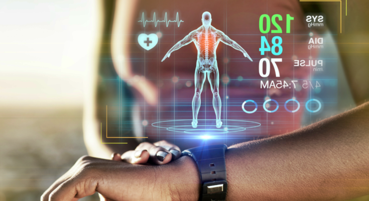 Wearable Technology