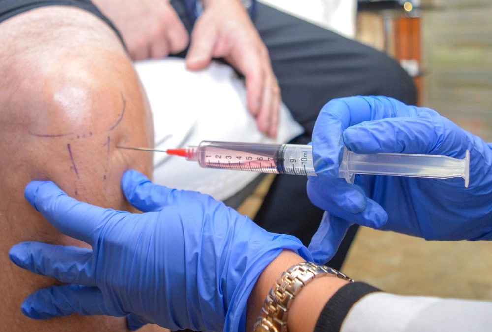 Stem Cell Therapy