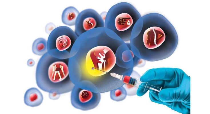 Stem Cell Therapy