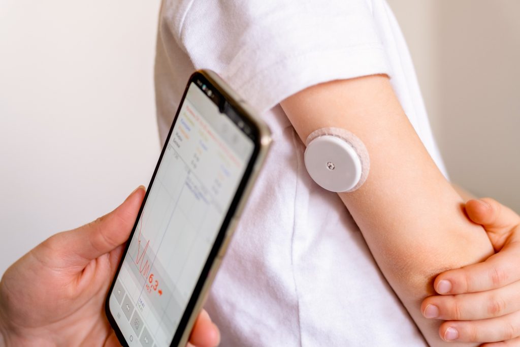 Glucose Monitor: Teknologi Pemantau Gula Darah yang Mengubah Gaya Hidup Diabetesi Modern