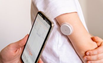 Glucose Monitor: Teknologi Pemantau Gula Darah yang Mengubah Gaya Hidup Diabetesi Modern
